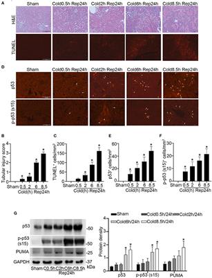 Proximal Tubule p53 in Cold Storage/Transplantation-Associated Kidney Injury and Renal Graft Dysfunction